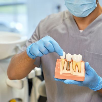 Dental Implants in North York